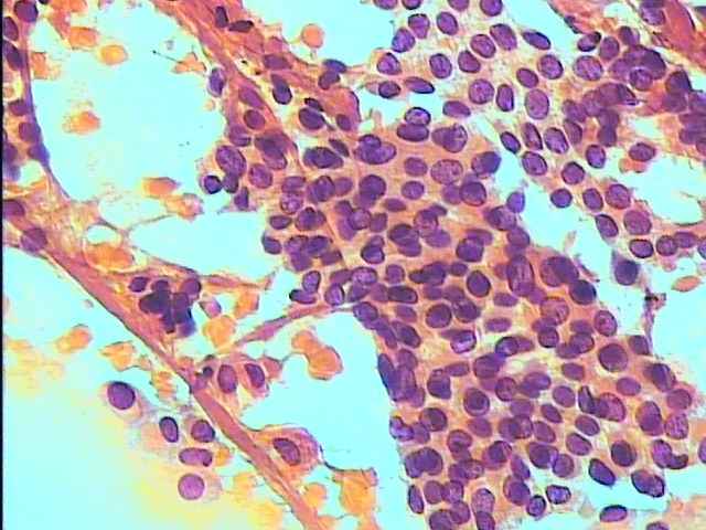 EXAME CITOPATOLÓGICO